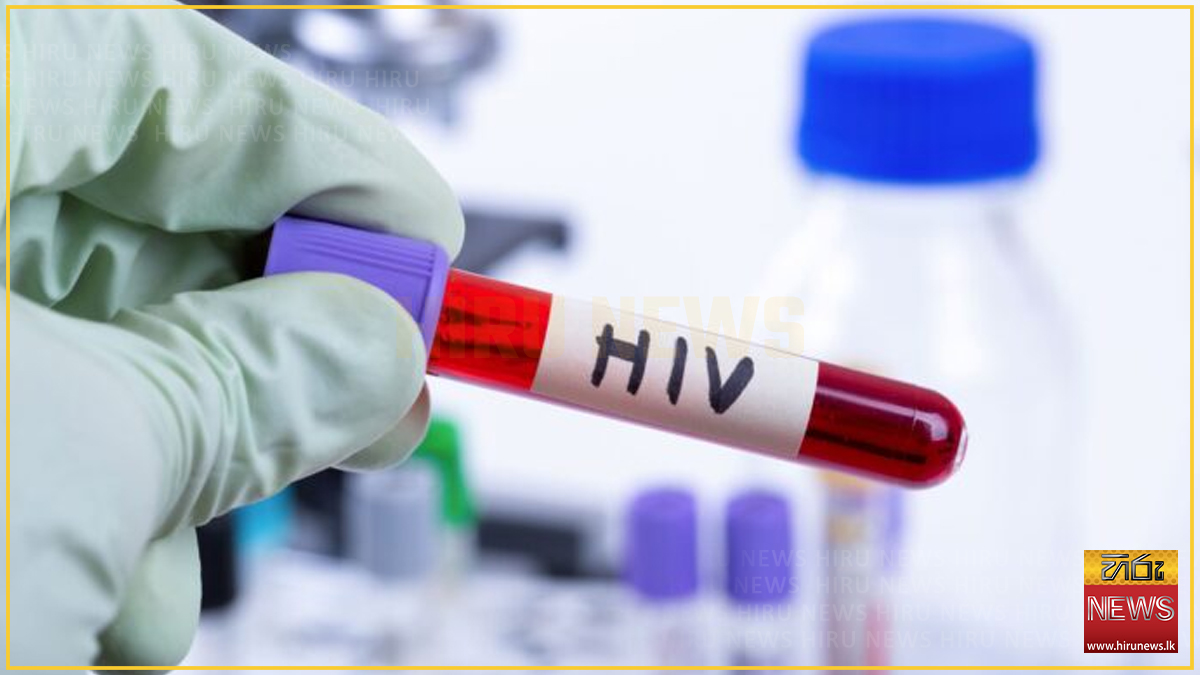 HIV ආසාදිතයින් වාර්තා වීම ඉහළට - Hiru News - Srilanka's Number One News ...