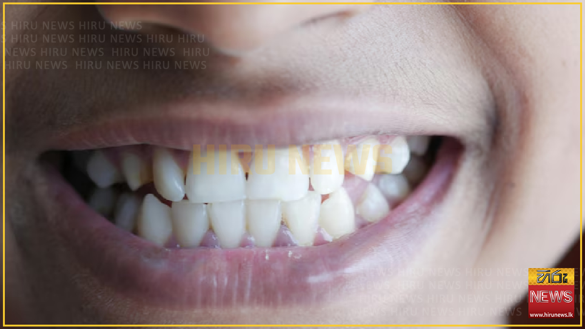 Teeth Nes What our teeth reveal about the growing gap between rich and poor ...