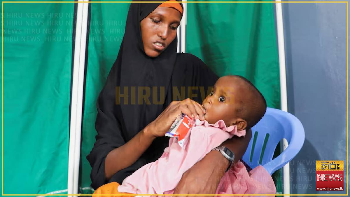 Somalia's malnourished children hit hard by Iran war