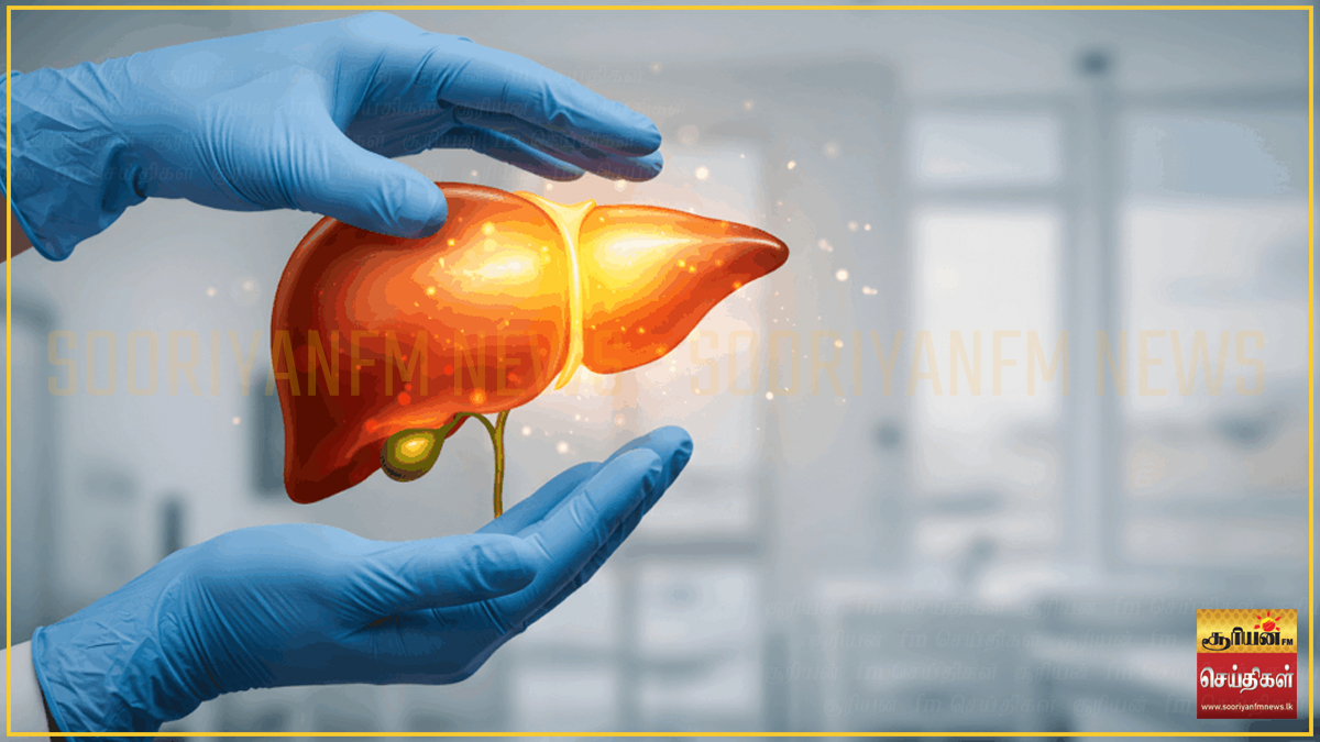 இலங்கையின் நகர்ப்புற மக்களில் 30 வீதமானோருக்கு 'கொழுப்பு கல்லீரல்' பாதிப்பு : மருத்துவர்கள் எச்சரிக்கை!