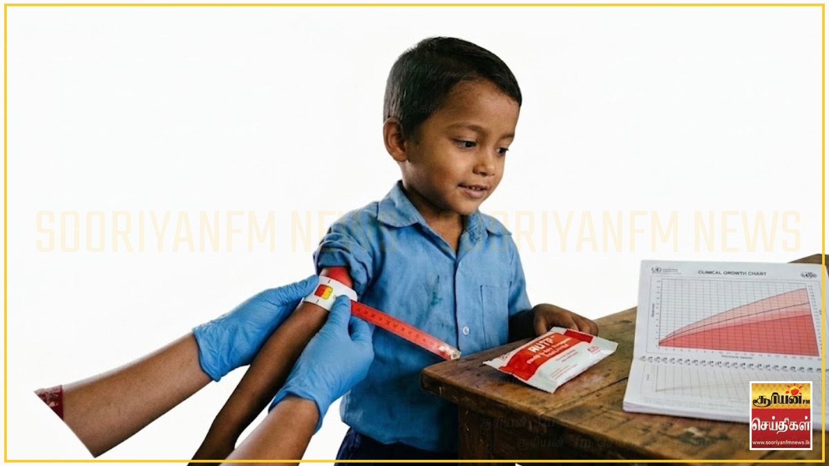 இலங்கையில் ஐந்து சிறுவர்களில் ஒருவர் ஊட்டச்சத்துக் குறைபாட்டினால் பாதிப்பு