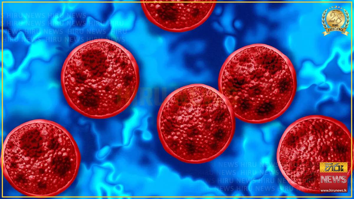 Michigan reports 5,002 cyclosporiasis cases