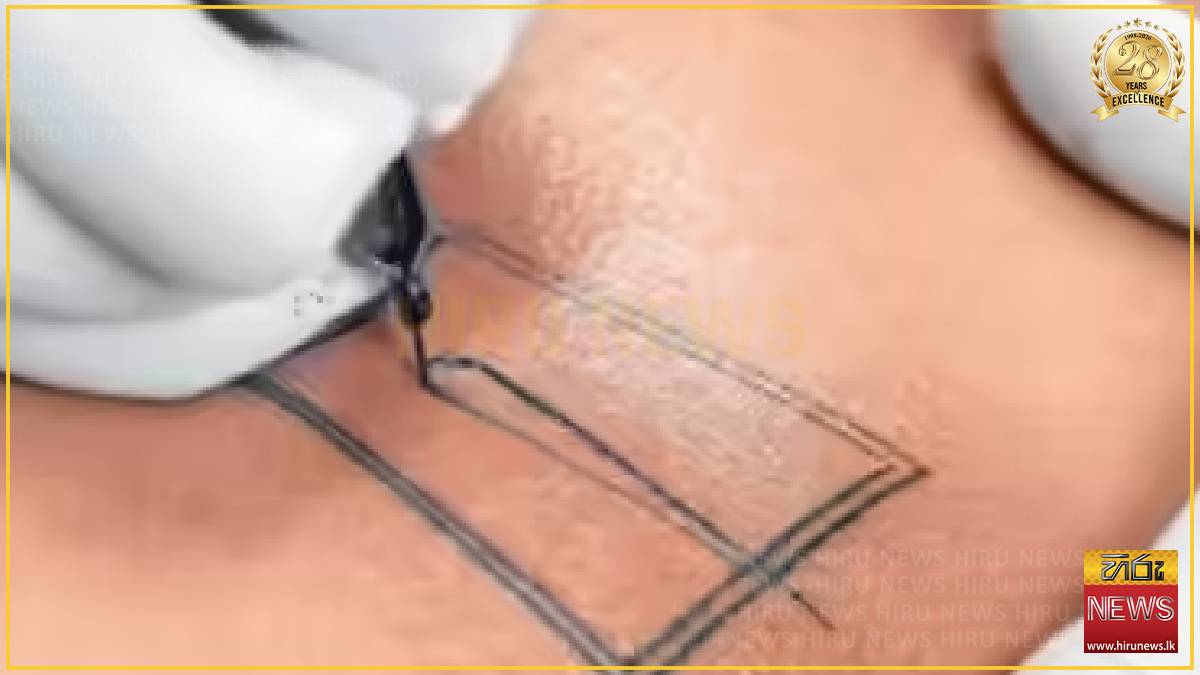 Kanpur woman test HIV+ weeks after tattoo in New Delhi
