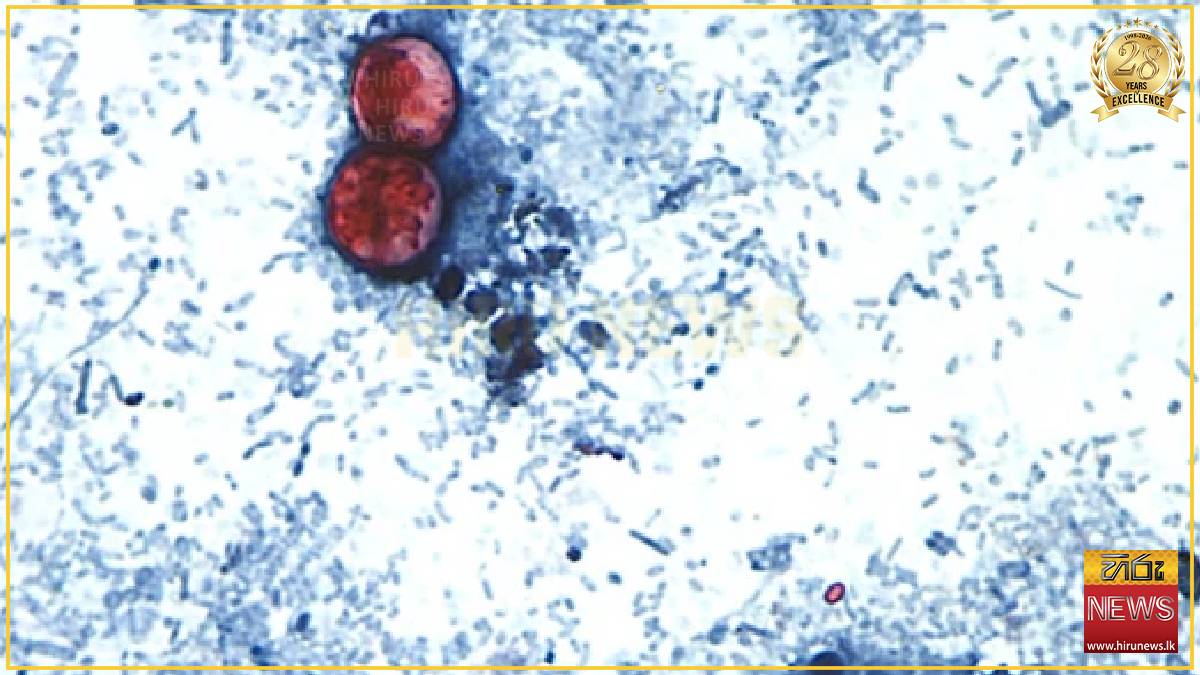 Taylor Farms recalls lettuce shipped to 27 states over cyclospora risk