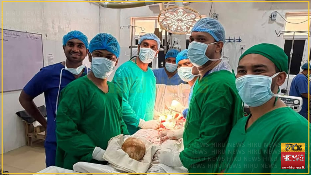 ත්‍රිකුණාමල මහ රෝහලේ වෛද්‍යවරු රෝගියකුගේ කිලෝ 3ක වකුගඩුවේ ගලක් ඉවත් කරමින් කළ විස්මිත සැත්කම
